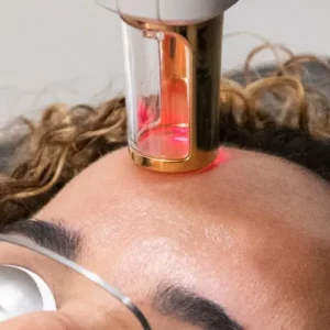 Advanced Photo-Frac & Resurfx Non-Ablative