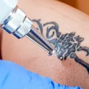 Laser Fundamentals & Safety